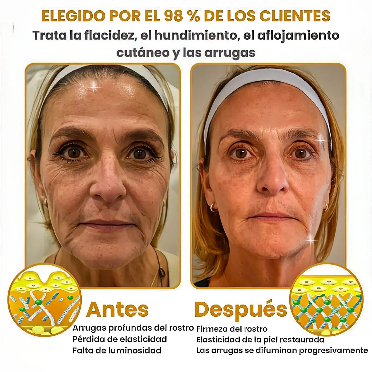 BOTOX® - Reduce las arrugas en 2 minutos - Sérum antiedad rápido y eficaz - Ahorra tiempo y dinero