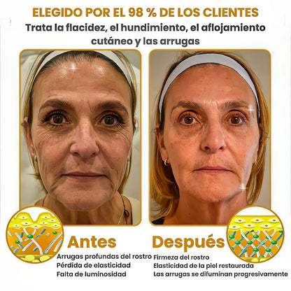 BOTOX® - Reduce las arrugas en 2 minutos - Sérum antiedad rápido y eficaz - Ahorra tiempo y dinero